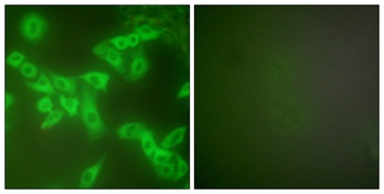 Cystatin B rabbit pAb
