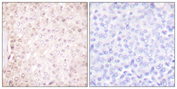 Cystatin B rabbit pAb