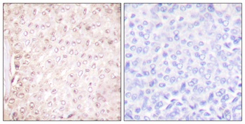 Cystatin B antibody