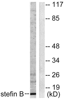 Cystatin B rabbit pAb
