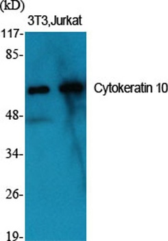 Cytokeratin 10 rabbit pAb