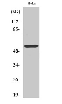 Cytokeratin 10 rabbit pAb