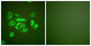 Cytokeratin 10 rabbit pAb