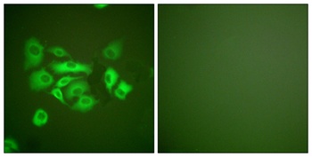 Cytokeratin 10 antibody