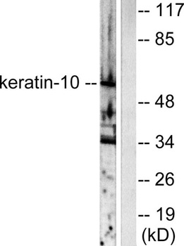 Cytokeratin 10 rabbit pAb