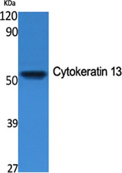 Cytokeratin 13 rabbit pAb