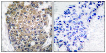 Cytokeratin 17 rabbit pAb