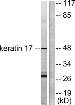 Cytokeratin 17 antibody