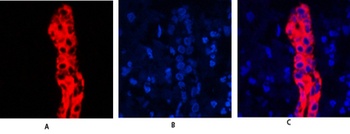 Cytokeratin 19 rabbit pAb