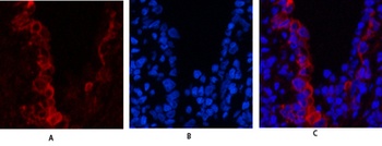 Cytokeratin 19 antibody