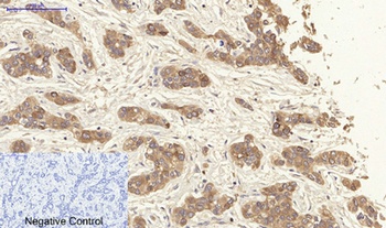 Cytokeratin 19 antibody