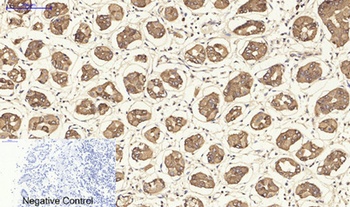 Cytokeratin 19 rabbit pAb