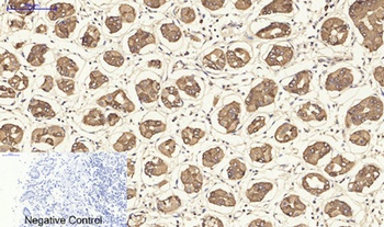 Cytokeratin 19 antibody