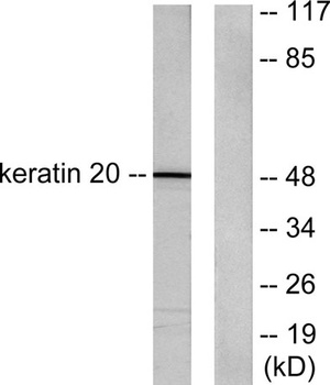 Cytokeratin 20 rabbit pAb Antibody