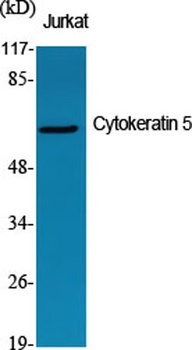 Cytokeratin 5 rabbit pAb