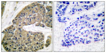 Cytokeratin 5 rabbit pAb