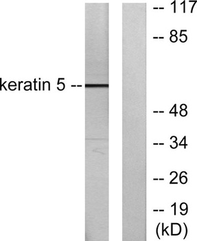 Cytokeratin 5 rabbit pAb