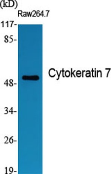 Cytokeratin 7 rabbit pAb