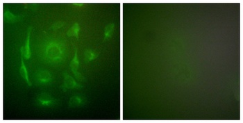 Cytokeratin 7 rabbit pAb