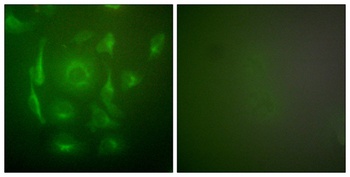 Cytokeratin 7 antibody