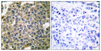 Cytokeratin 7 rabbit pAb