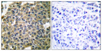 Cytokeratin 7 antibody