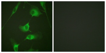 Cytokeratin 8 rabbit pAb