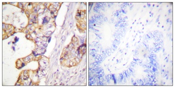 Cytokeratin 8 rabbit pAb