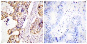 Cytokeratin 8 antibody