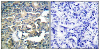 Cytokeratin 8 rabbit pAb