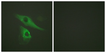 Cytokeratin 8 rabbit pAb