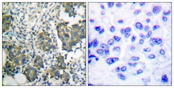 Cytokeratin 8 rabbit pAb