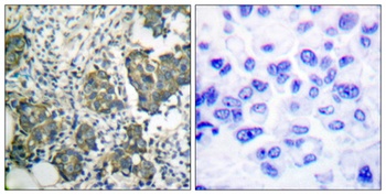 Cytokeratin 8 antibody