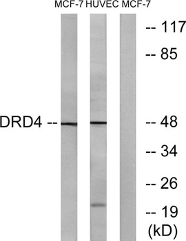 D4DR rabbit pAb