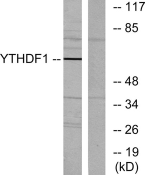DACA-1 antibody