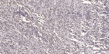 DACA-1 antibody