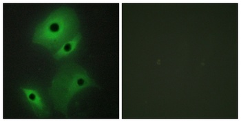 DAN antibody