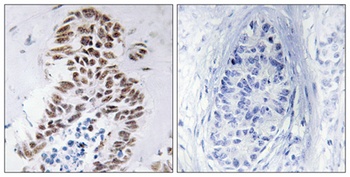 DAPK3 antibody