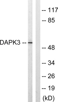 DAPK3 rabbit pAb
