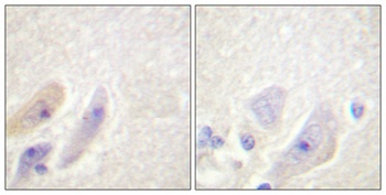 DARPP-32 antibody