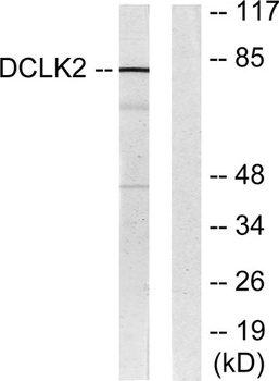 DCAMKL2 antibody