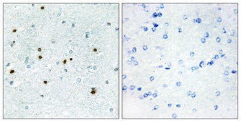 DCAMKL3 antibody