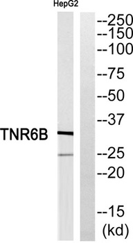 DcR3 rabbit pAb