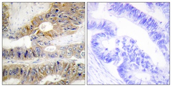 DcR3 antibody