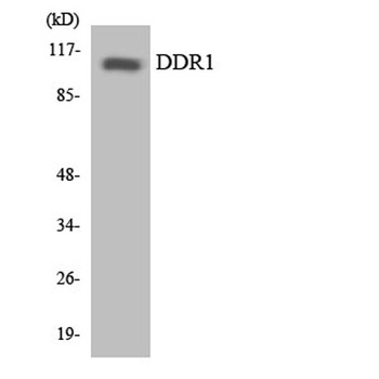 DDR1 antibody