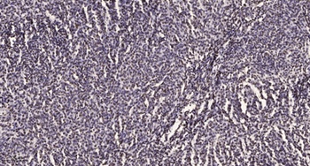 DDX19B antibody