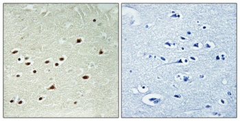 DDX51 antibody