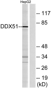 DDX51 rabbit pAb