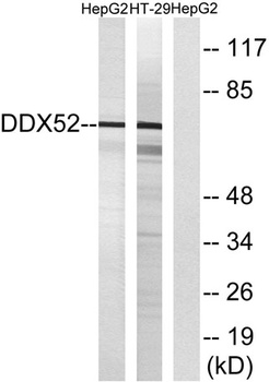 DDX52 rabbit pAb