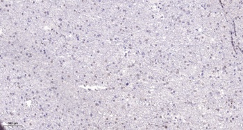 DDX52 antibody